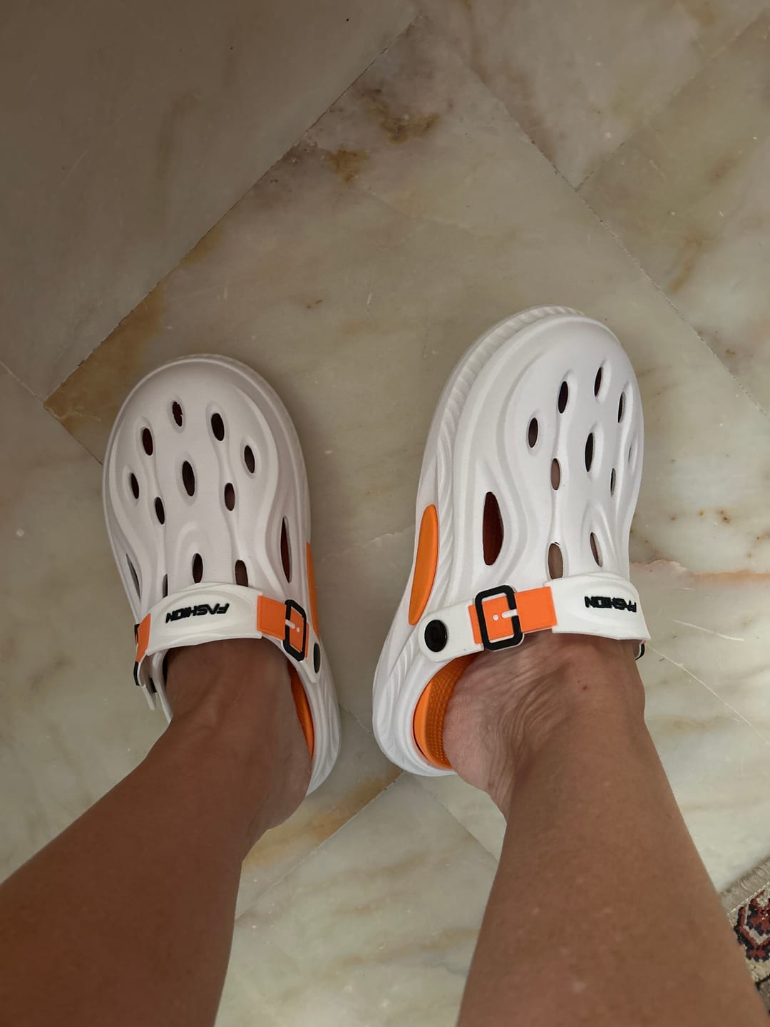 Customer photo review of Ortopedik Sandalet