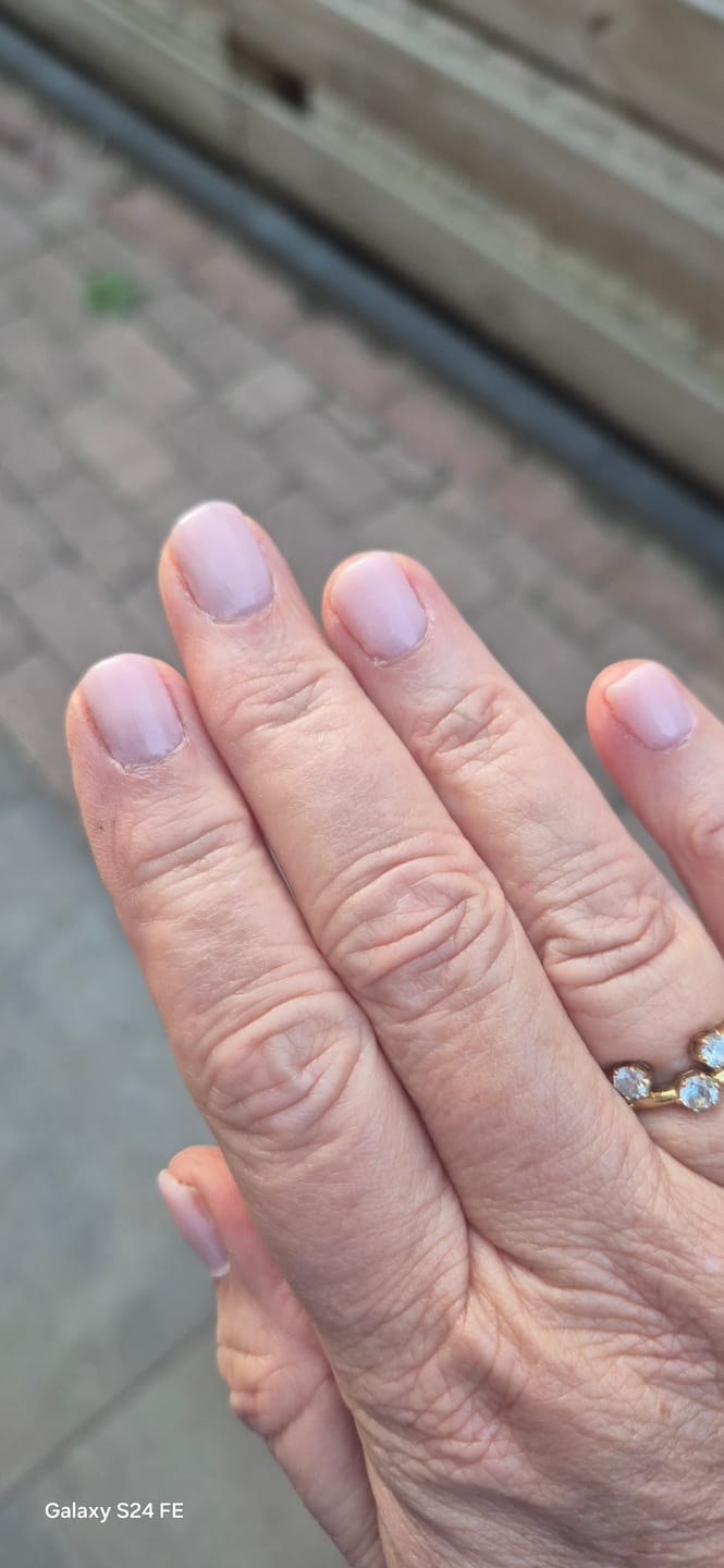 Customer photo review of Premium 4-In-1 Buffervijl