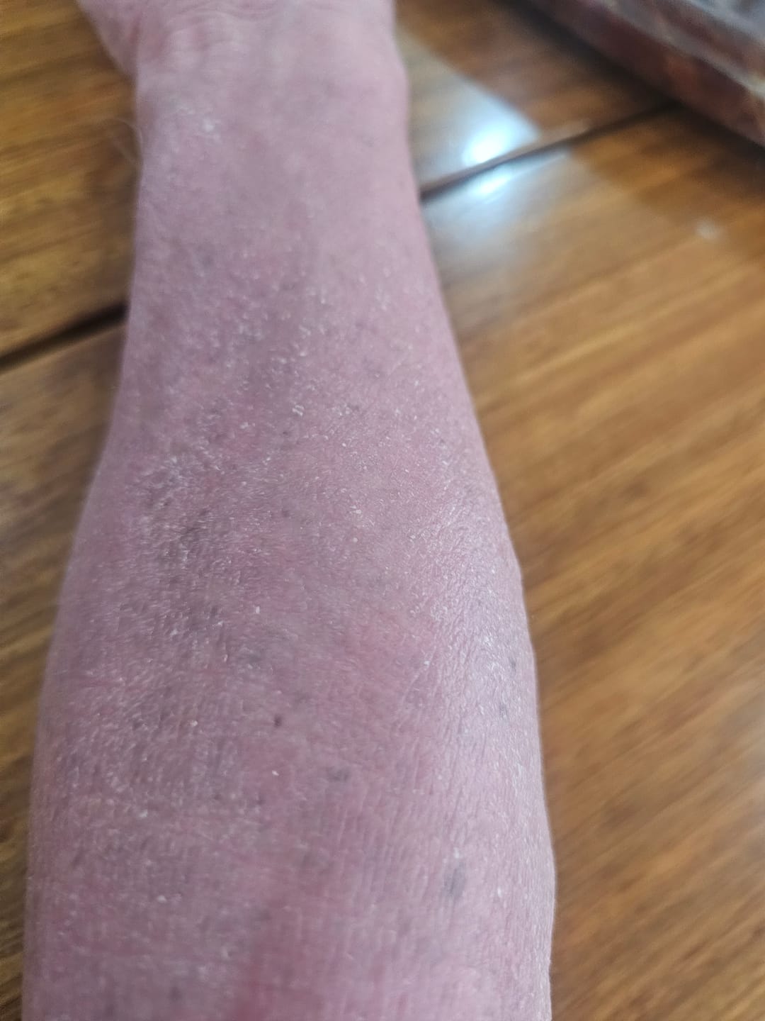 Customer photo review of RCV PRO – The Revolutionary Skin Supplement