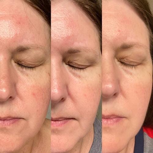 Customer photo review of Masque Haute Performance LED