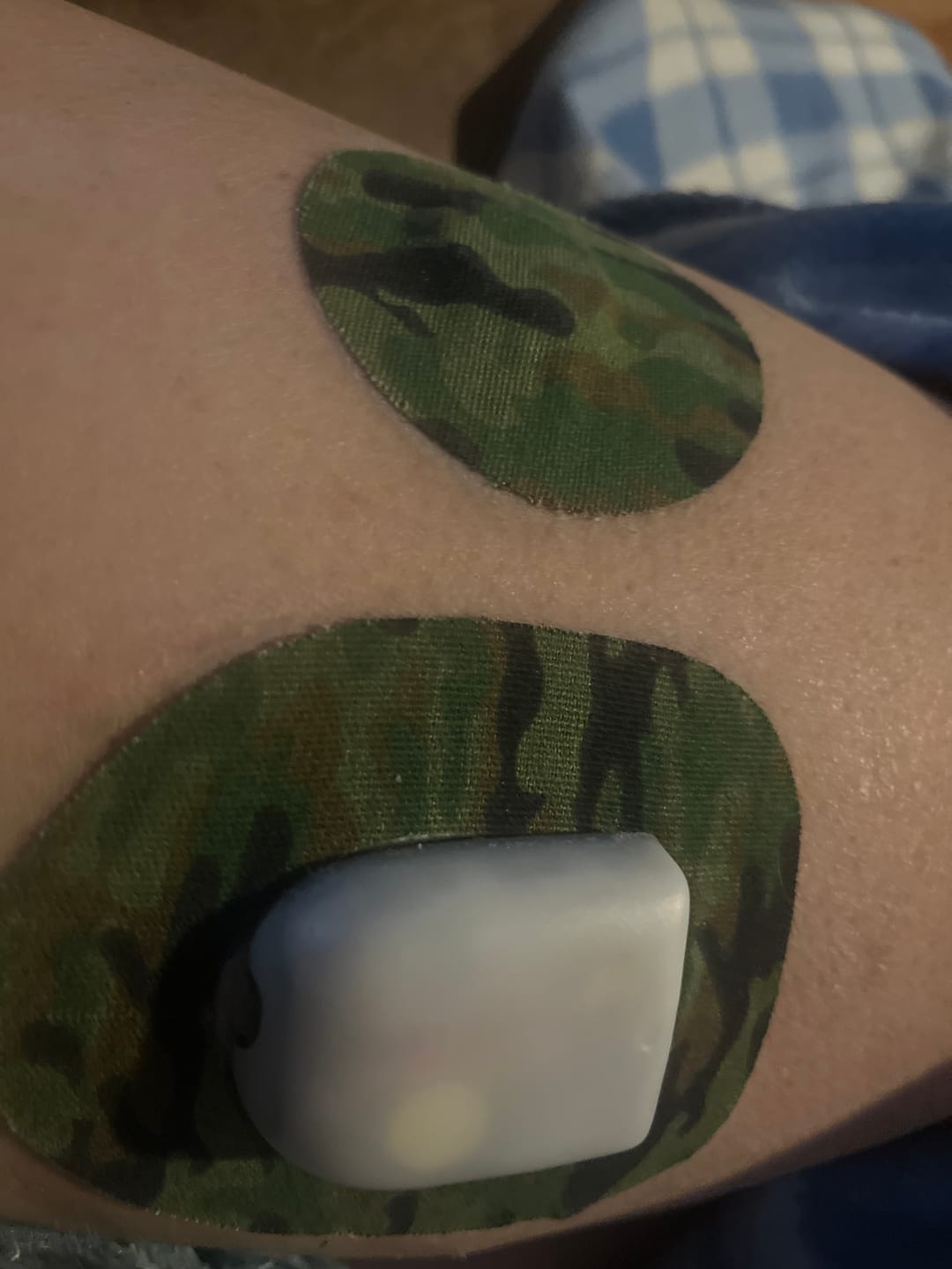 Customer photo review of Skin Grip Original - Omnipod Adhesive Patches