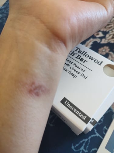 Customer photo review of The Tallowed Truth Bar - Tallow Soap 3 Pack