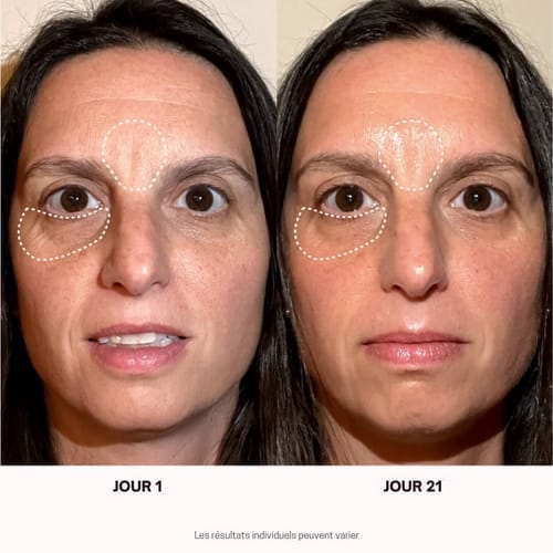 Customer photo review of Masque Haute Performance LED