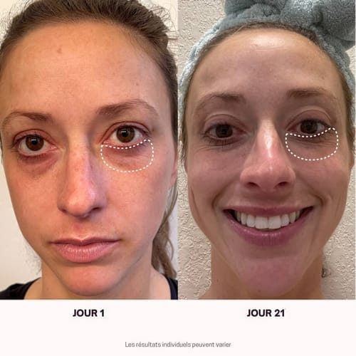 Customer photo review of Masque Haute Performance LED