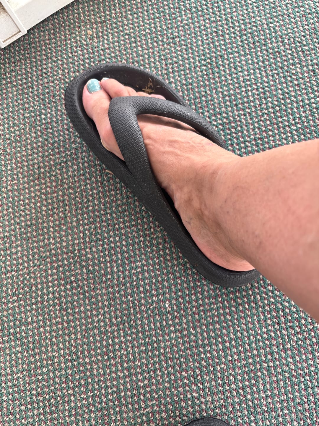 Customer photo review of Orthopedic Flip Flops - Cloud Slides