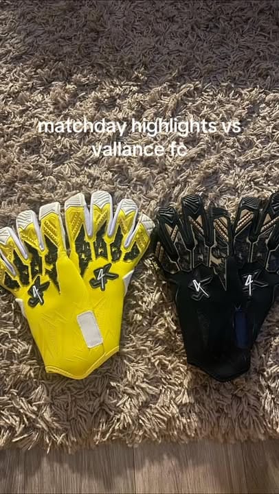 Customer photo review of Anomaly S.25 Roll Finger