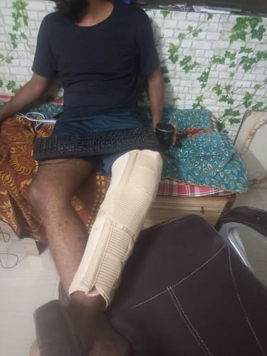 Customer photo review of Knee Brace - Long (19" Brace) | Ideal firm Knee support that limits knee motion & stabilizes the knee with mediolateral metal supports | Color - Beige