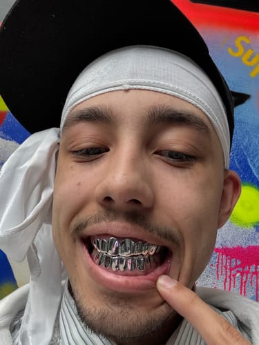Customer photo review of TEMPO (16 PC SILVER GRILLZ)