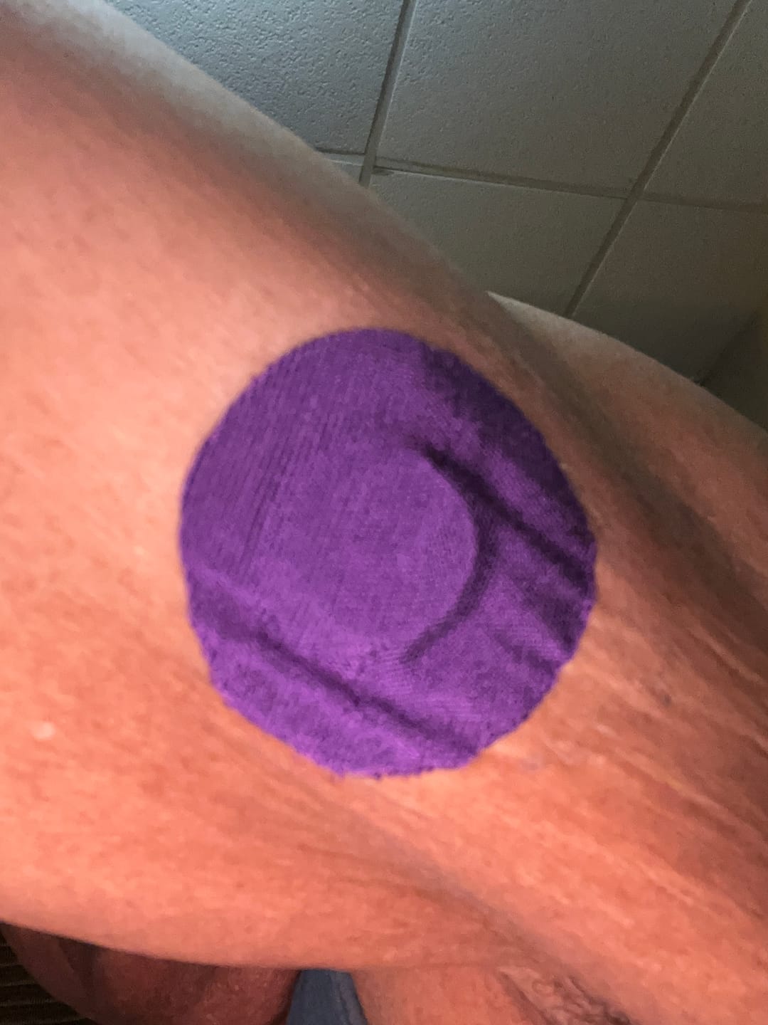 Customer photo review of Skin Grip Original - Libre 3 Adhesive Patches