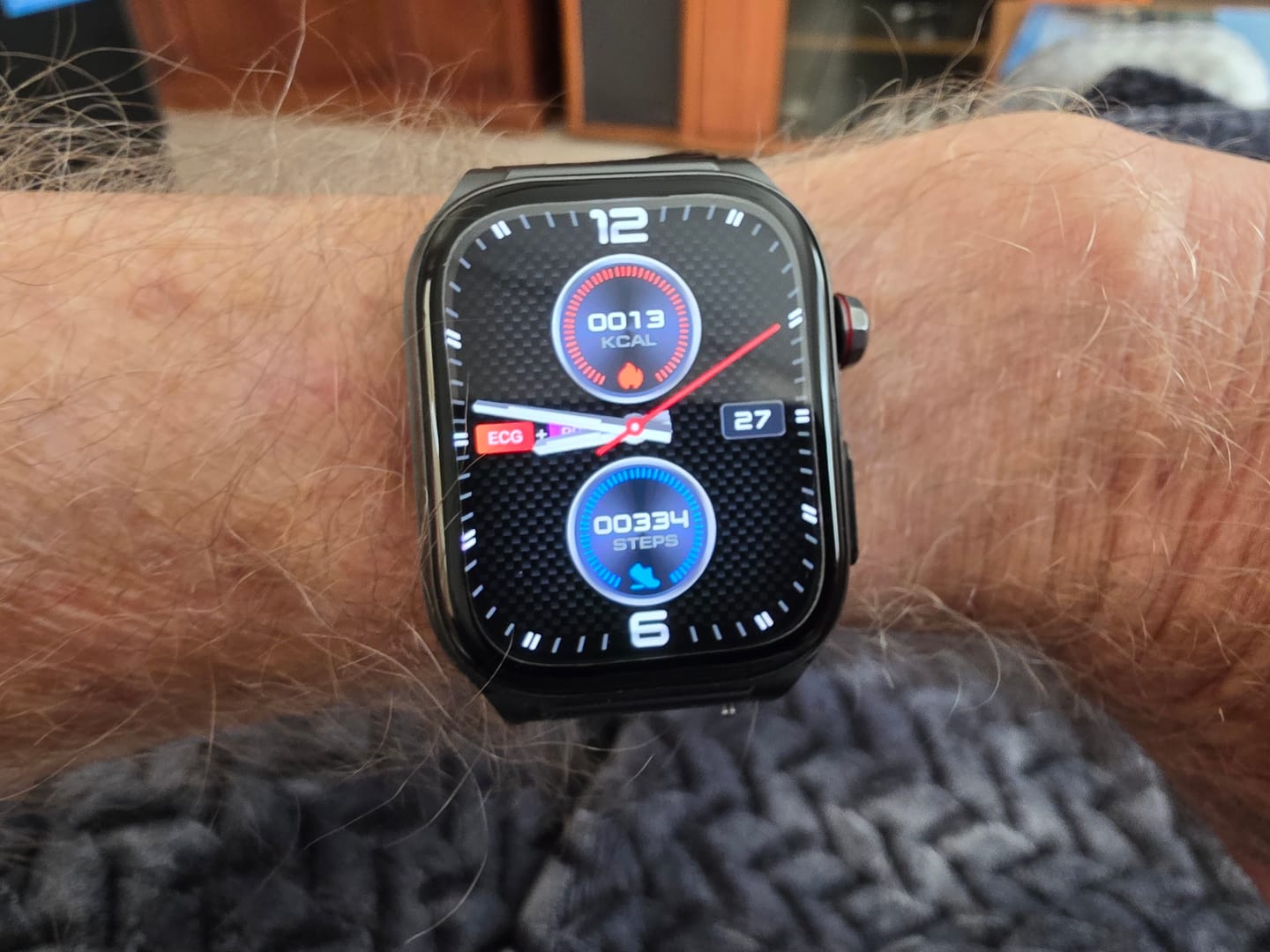 Customer photo review of Fitaos Pro 9 High-end Flagship Smartwatch ECG blood glucose Uric acid cholesterol Stress monitoring