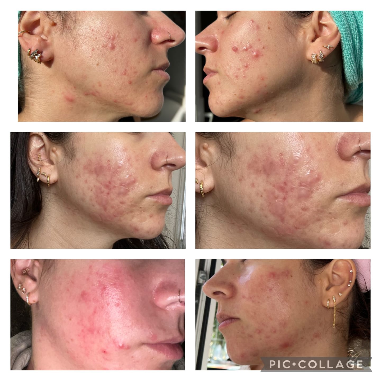 Customer photo review of PMS + Stress Formula