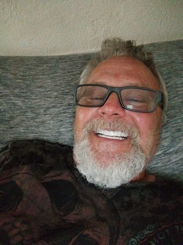 Customer photo review of Pop On Veneers with Impression Kit