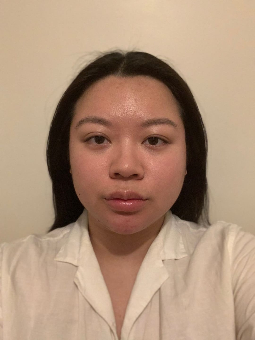 Customer photo review of Acne Formula