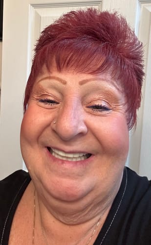 Customer photo review of FIRST REMAKE Pop On Veneers