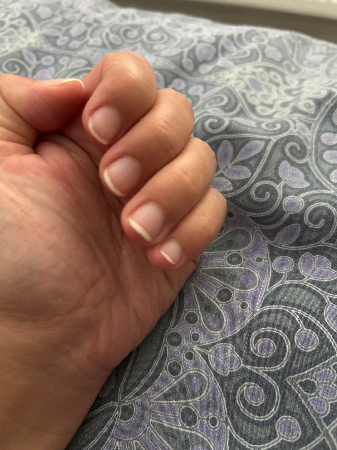Customer photo review of LU'NAIL Tırnak Bakım Kalemi