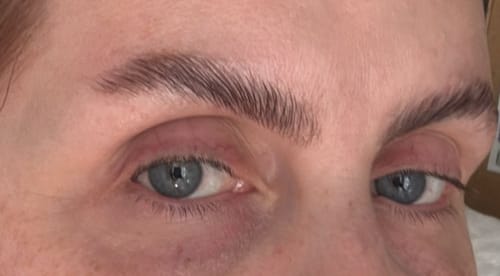 Customer photo review of TGA vs Cysteamine