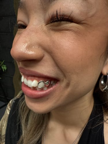 Customer photo review of FREE "PRISM" (SILVER GRILLZ)