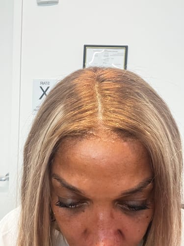 Customer photo review of Peach Hold Me Down™ Adhesive SPORT (Ain’t No Other™)