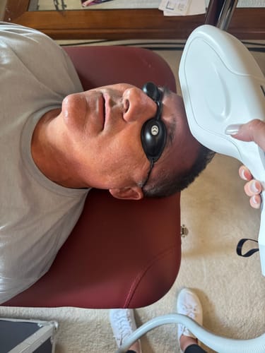 Customer photo review of DermaLaze™ Delicate 3 in 1 E-Light Skin Rejuvenation System - Portable