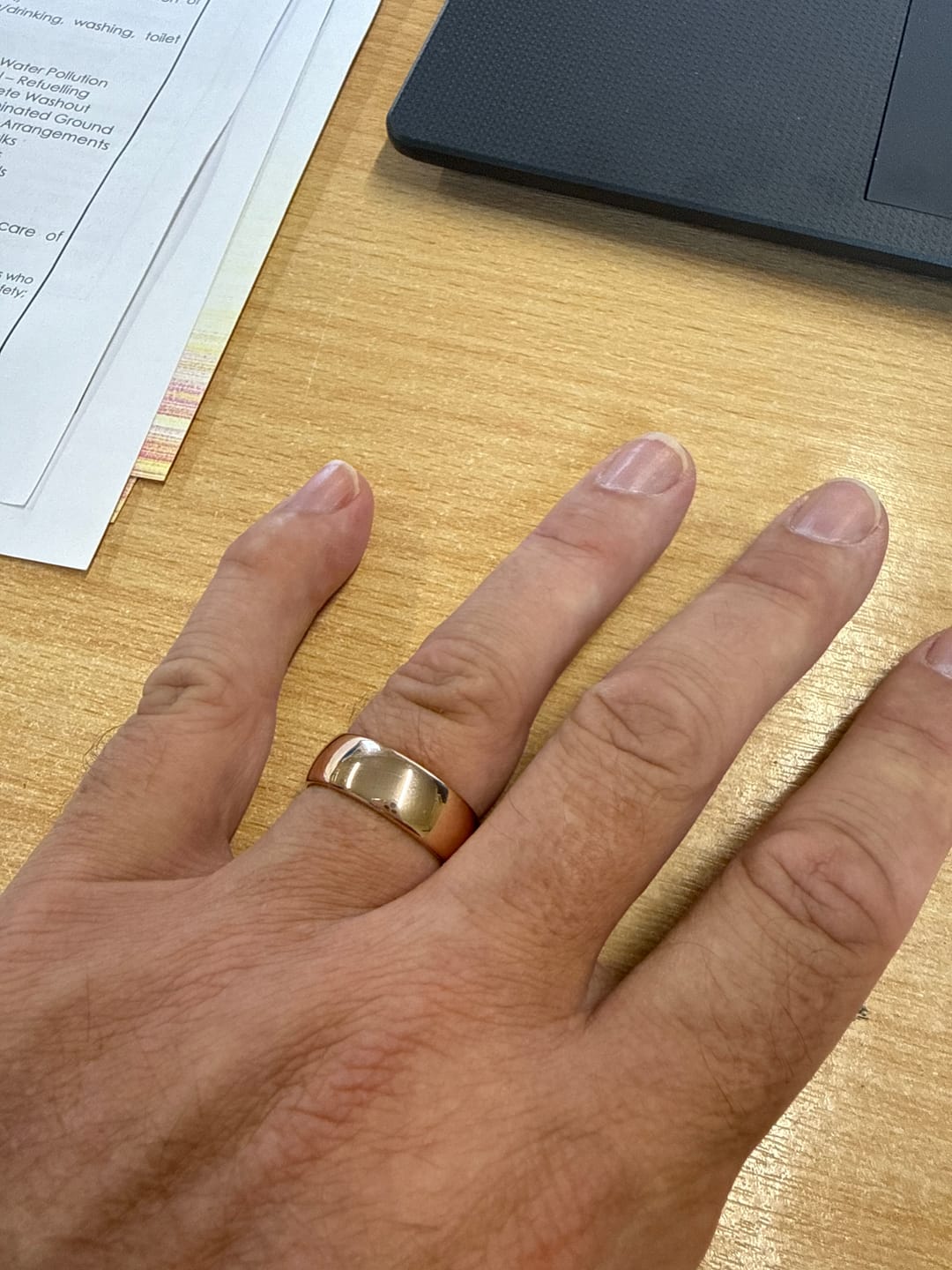 Customer photo review of Rose Gold 8mm Wonder Ring