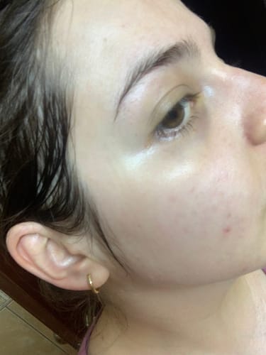 Customer photo review of 345 Relief Cream