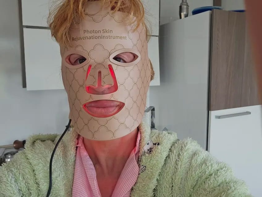 Customer photo review of LED Face Mask for Skin Rejuvenation and Wrinkle Reduction