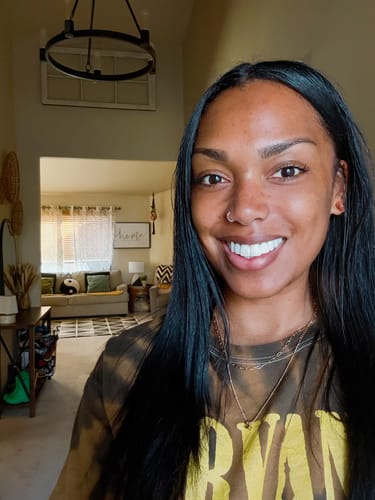 Customer photo review of Pop On Veneers with Impression Kit