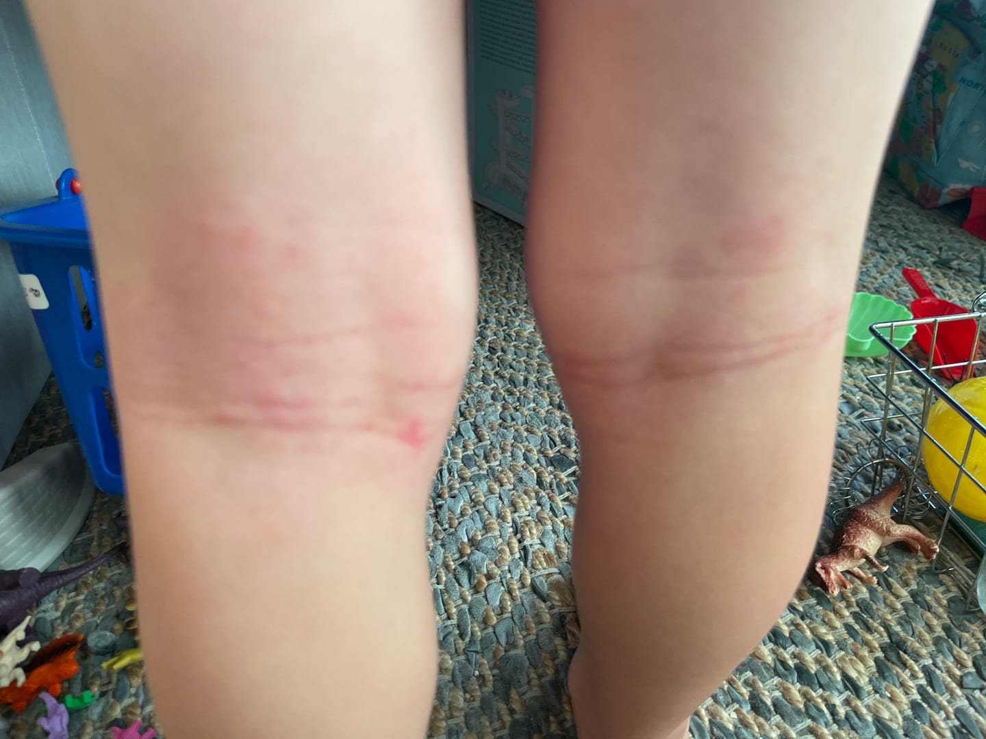 Customer photo review of Large Bioskin Junior Duo Pack