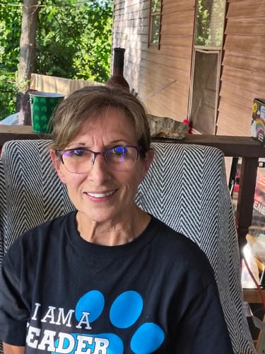 Customer photo review of Pop On Veneers with Impression Kit