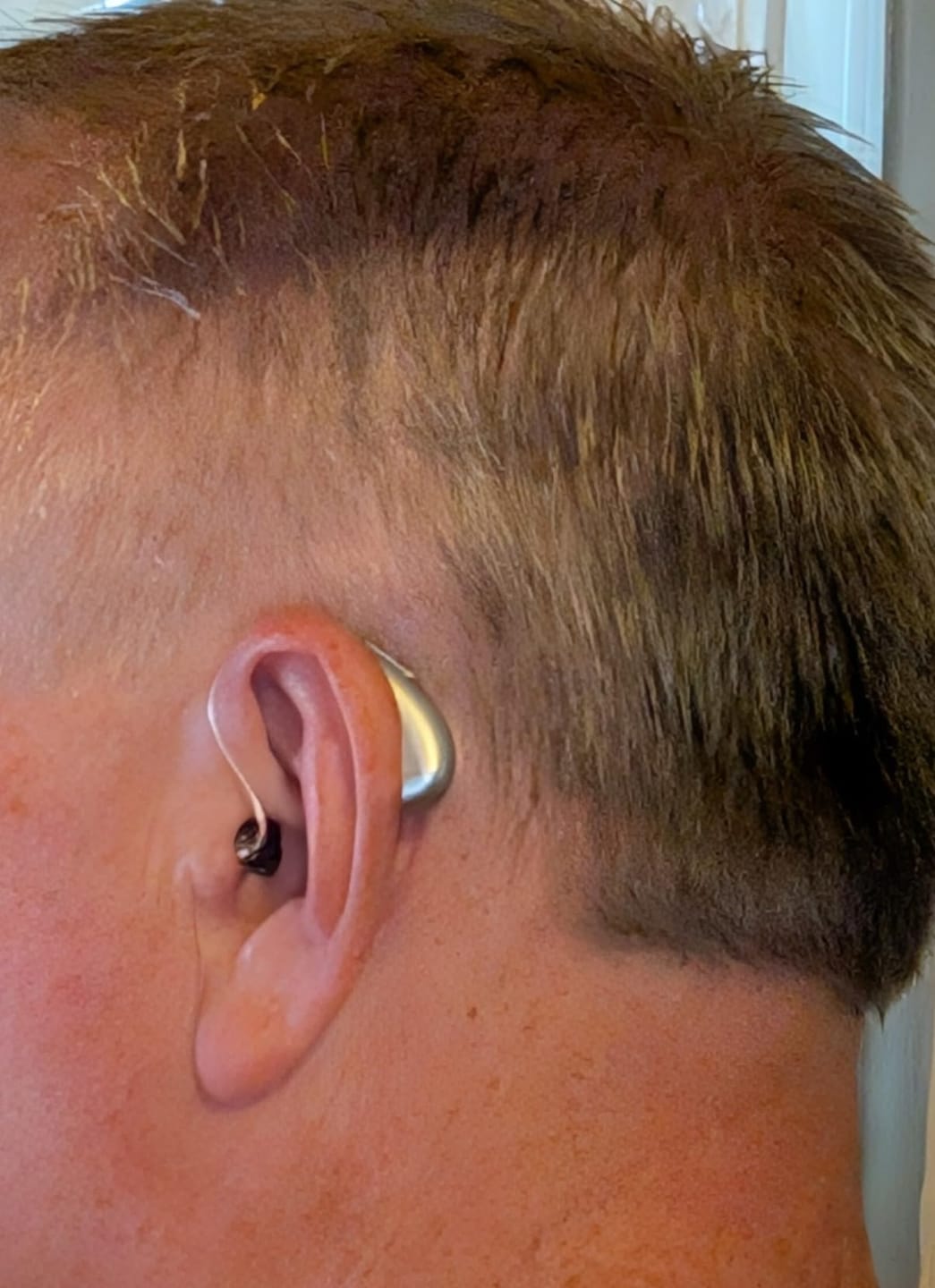 Customer photo review of WeRelieve™ OTC Hearing Aid