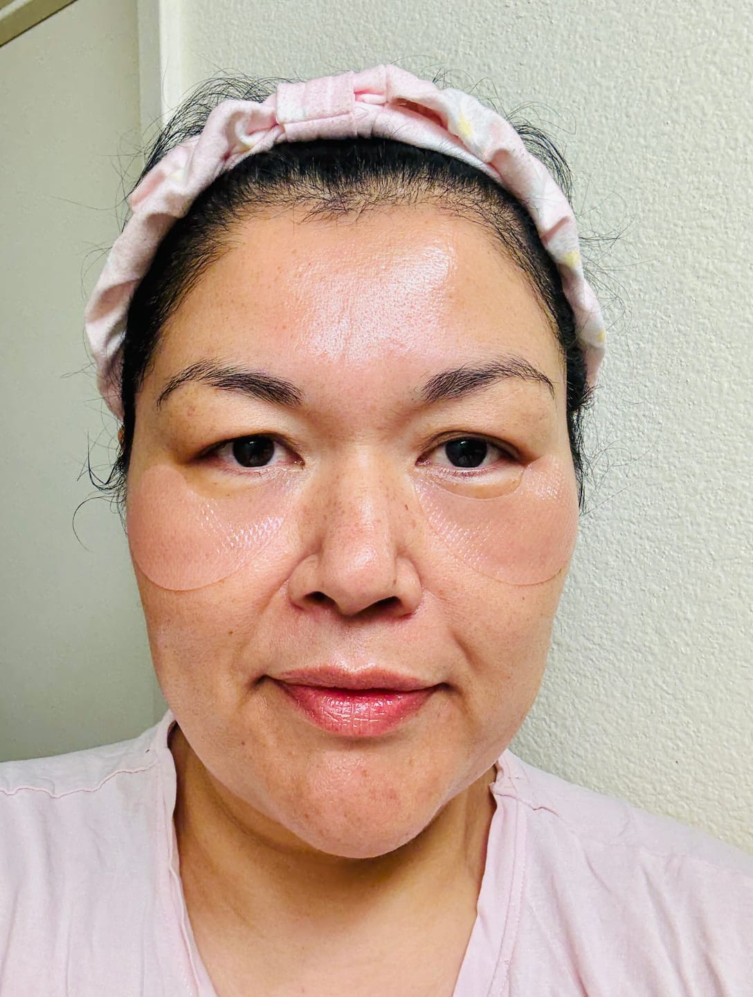 Customer photo review of PDRN retinal eye patch Glow jelly