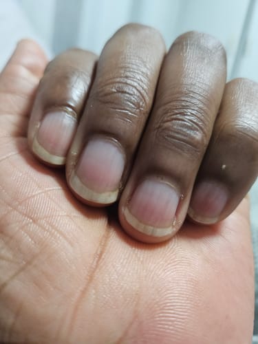 Customer photo review of Glow + Grow Hair Growth Collagen