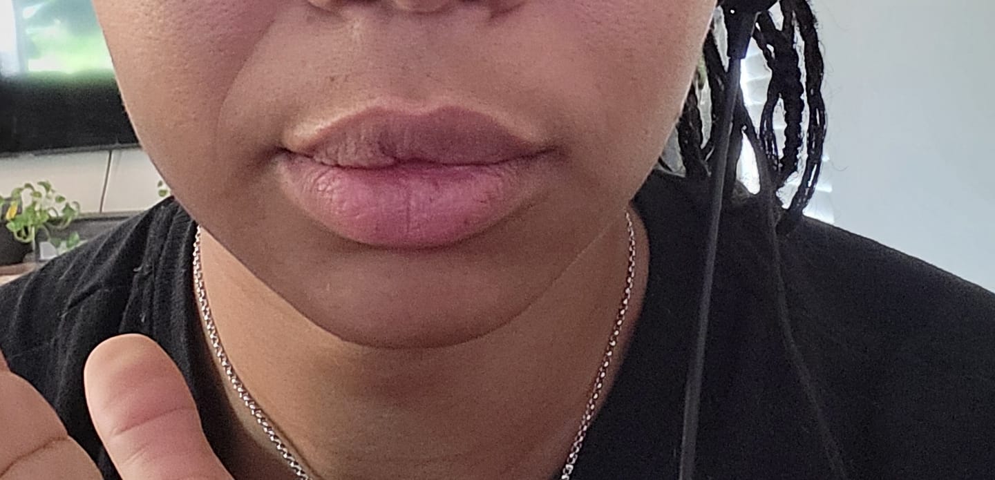 Customer photo review of Turmeric and Lemon Lip Balm (for Dark Lips)