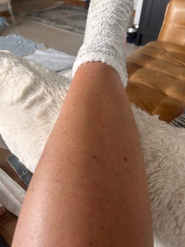 Customer photo review of Intensive Tanning Balm