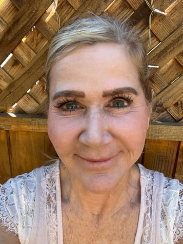 Customer photo review of HA Serum