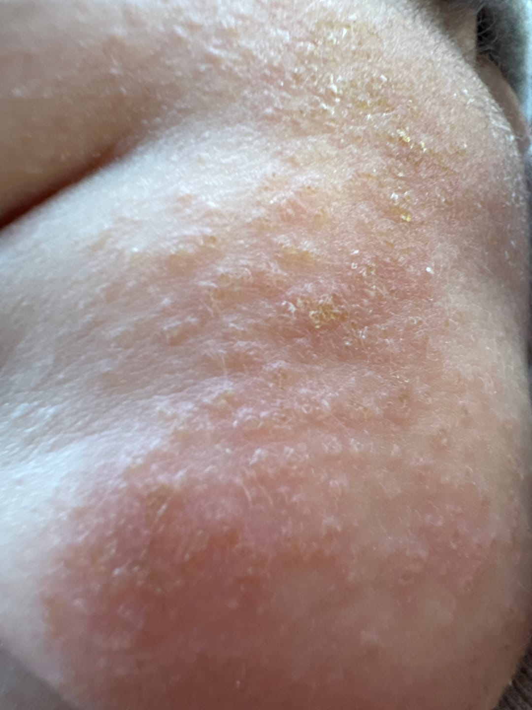 Customer photo review of Kawakawa Repair Balm - Winner, Best SOS/Healing Balm 2024