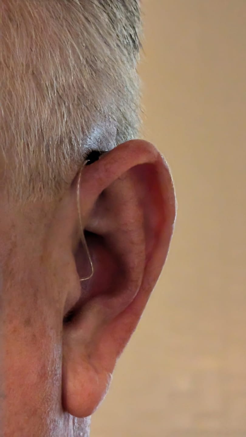 Customer photo review of WeRelieve™ OTC Hearing Aid