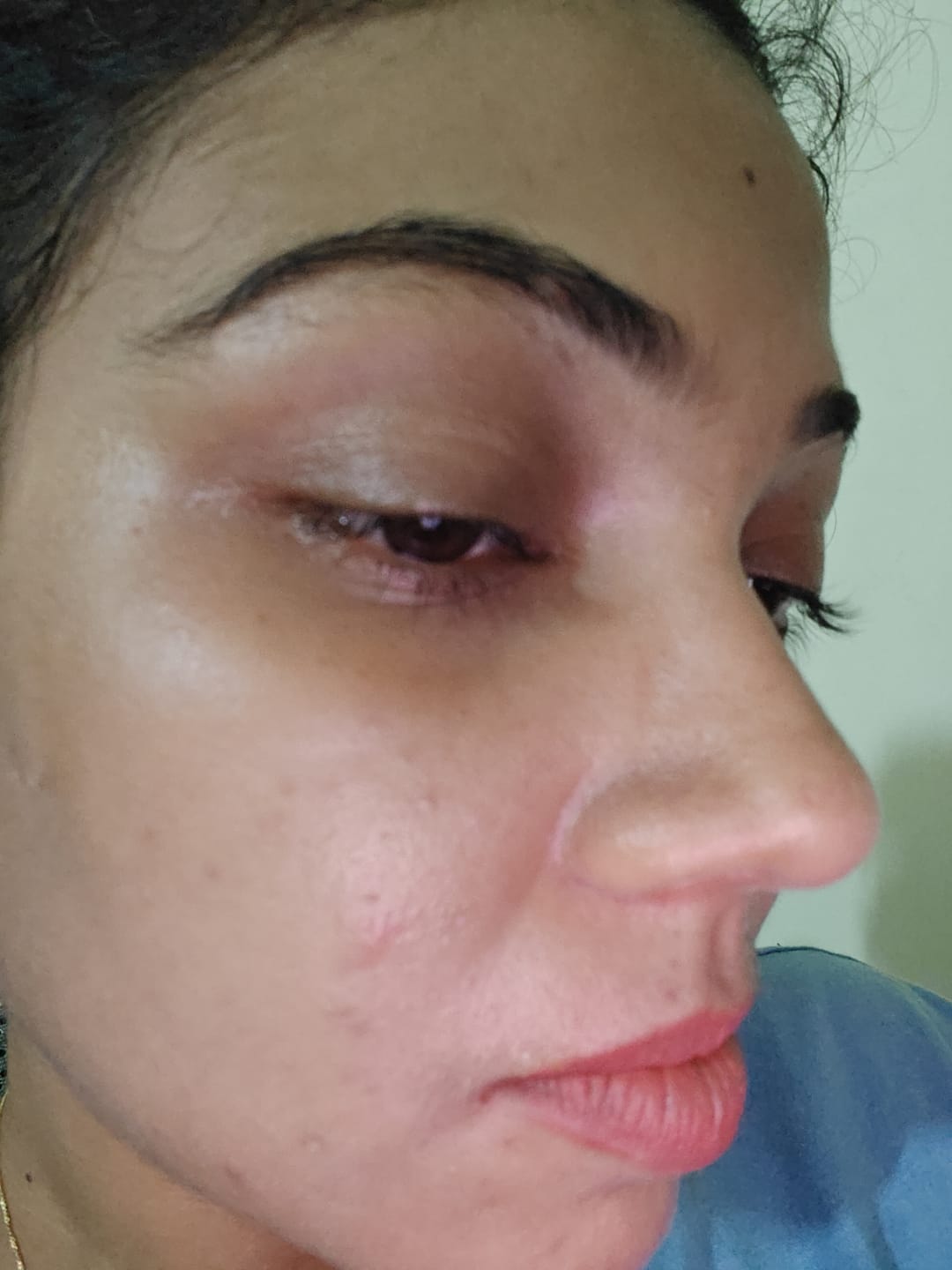 Customer photo review of Yuderma Renewcell Vitamin C serum