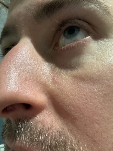 Customer photo review of Seb Natural Calming Serum