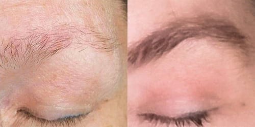 Customer photo review of IZABELL ROLLER - For eyebrows