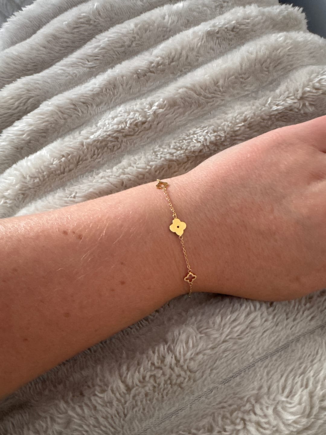 Customer photo review of Multi Clover Bracelet