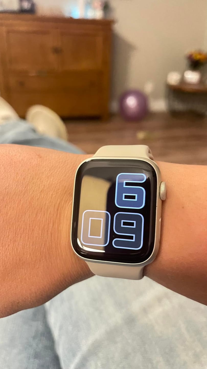 Customer photo review of Stella XS Smartwatch