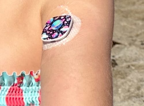 Customer photo review of Medtronic Simplera CGM Stickers - Playful Motifs