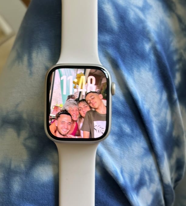 Customer photo review of Stella XS Smartwatch