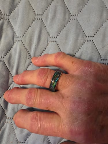 Customer photo review of Nerium
