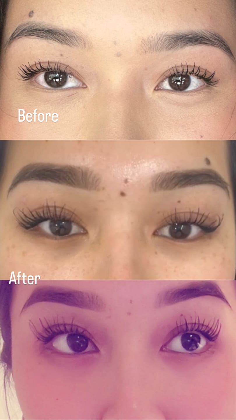 Customer photo review of WHOLESALE PACK: Eyelash Growth Serum