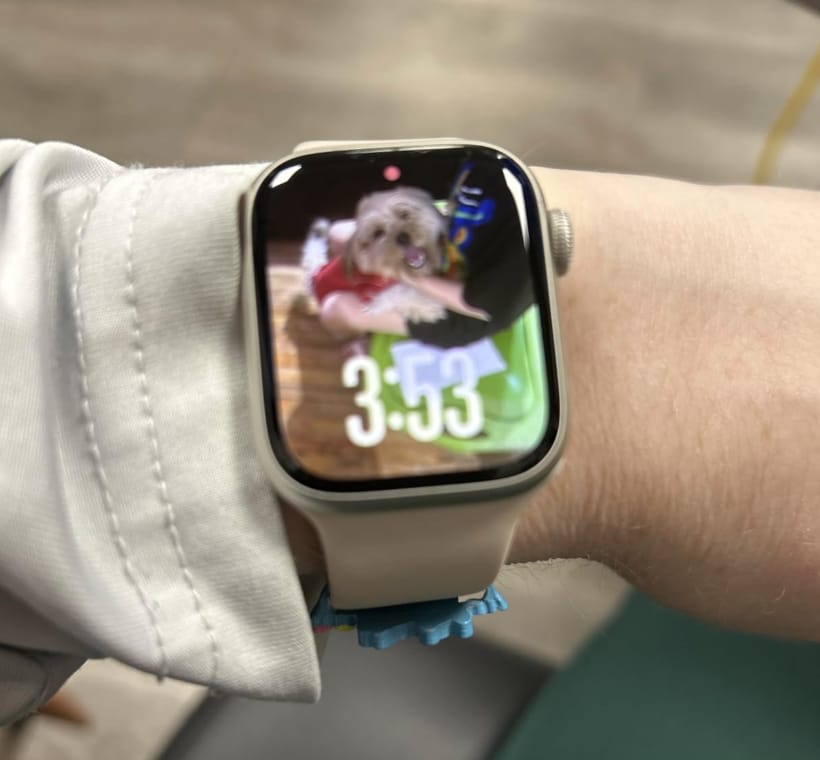 Customer photo review of Stella XS Smartwatch