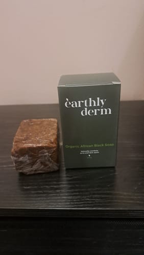 Customer photo review of Anti-Acne & Dark Spots African Soap