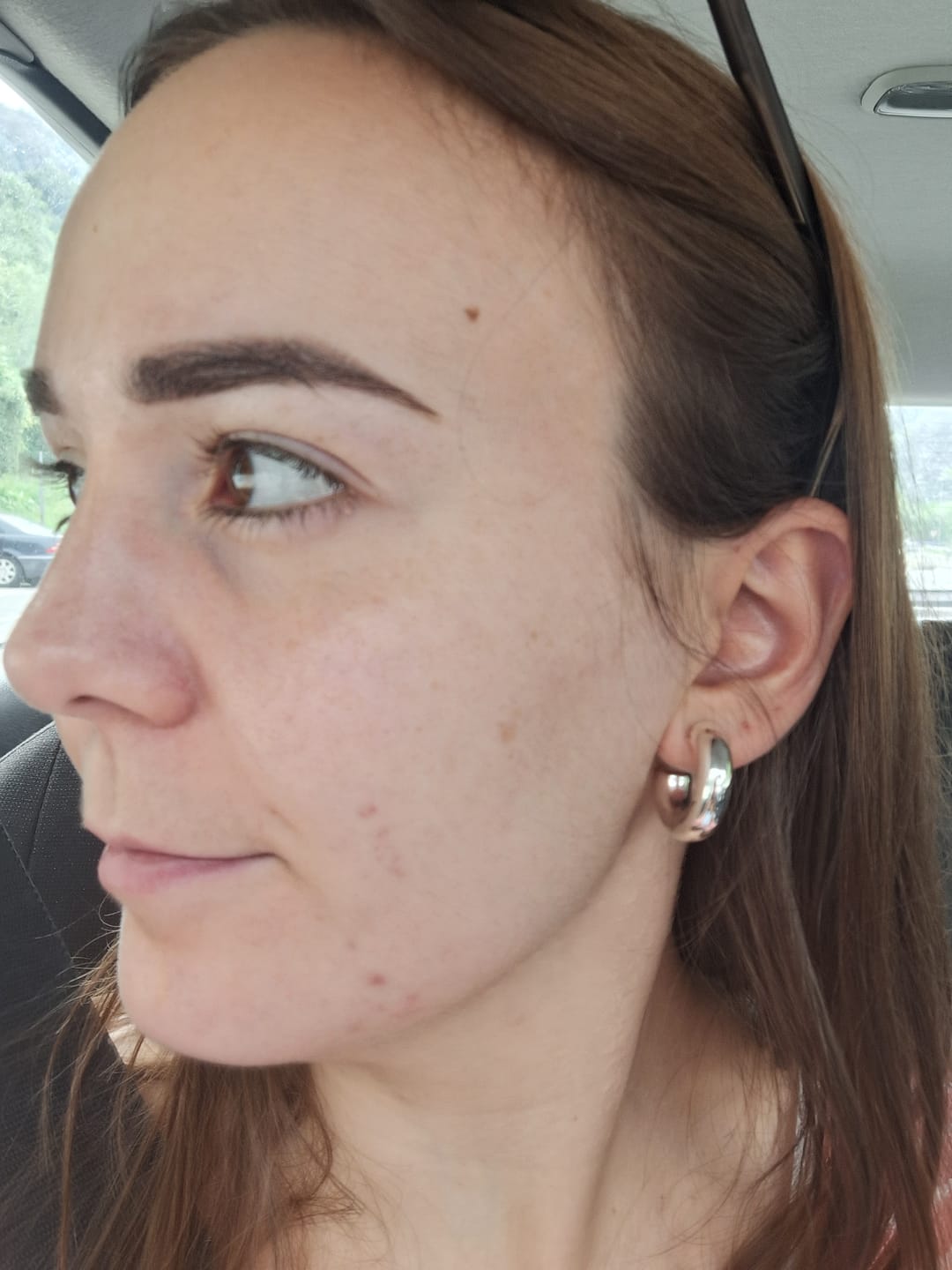 Customer photo review of RUTINA AM&PM - GRANITOS + MARCAS + POROS + MANCHAS + ARRUGAS
