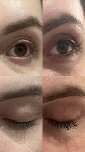 Customer photo review of KosmaLash® | Sérum Crecimiento & Anticaída